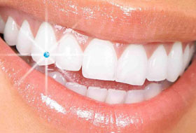 dental jewellery clinic in porbandar