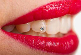 dental jewellery clinic in porbandar