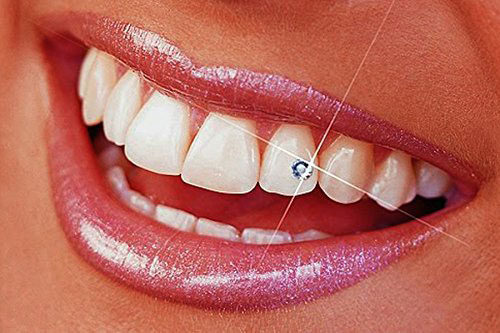 Dental jewelry on sale near me