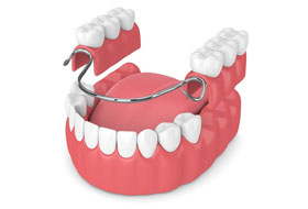 dentures clinic in porbandar