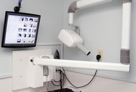 Digital X-ray in gujarat