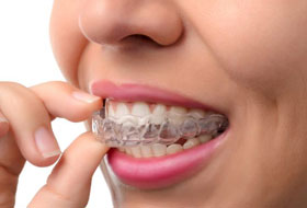 mouth guard in porbandar