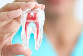 Root Canal Treatment in porbandar
