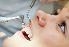 scaling and polishing treatment in porbandar