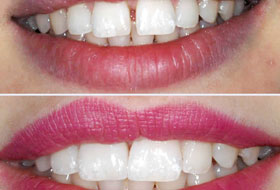 Smile Designing India