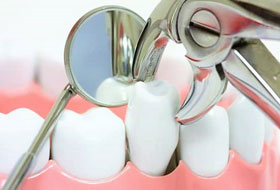 tooth extraction clinic in porbandar