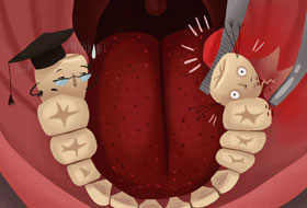 wisdom teeth surgery in porbandar